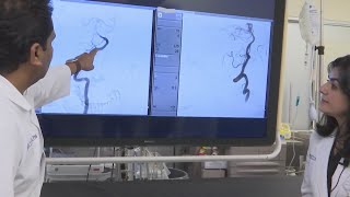 Doctors warn residents to be aware of signs of stroke Net Worth