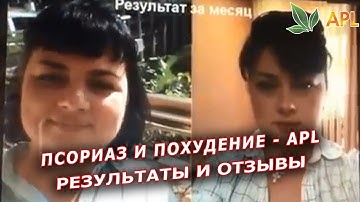 ОШЕЛОМЛЯЮЩИЕ РЕЗУЛЬТАТЫ по ПСОРИАЗУ|ОТЗЫВЫ,ЛЕЧЕНИЕ