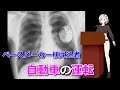 心臓ペースメーカー植込み者が注意を要するもの（運転）/VTuberノーラノーラにおまかせ!
