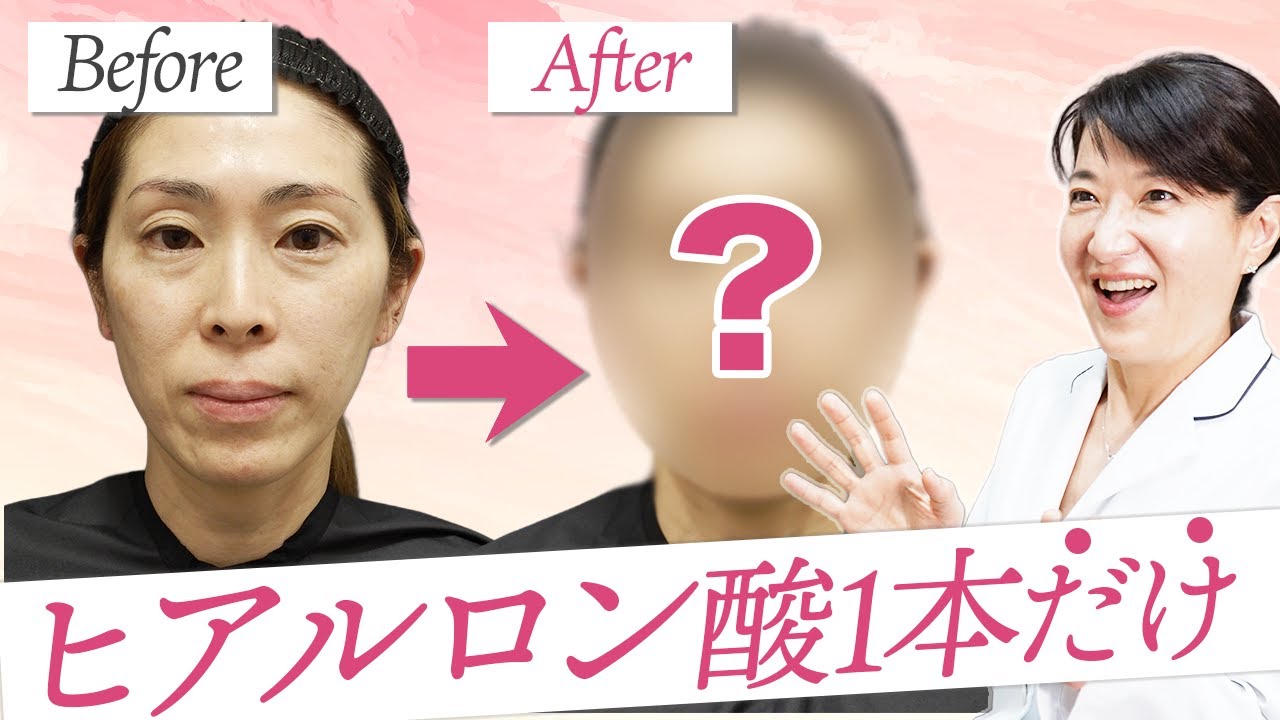 業務用美肌マシン 炭酸オキシジェネオ 日本語説明書 美肌になりたい！」を叶える炭酸ピーリングエステマシン！オキシ