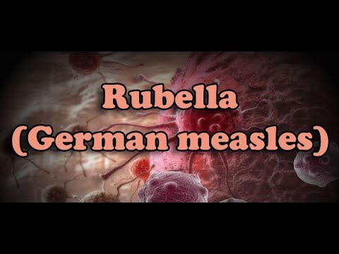 Video: Rubella Hos Voksne - Symptomer Og Behandling. Hvordan Fortelle?