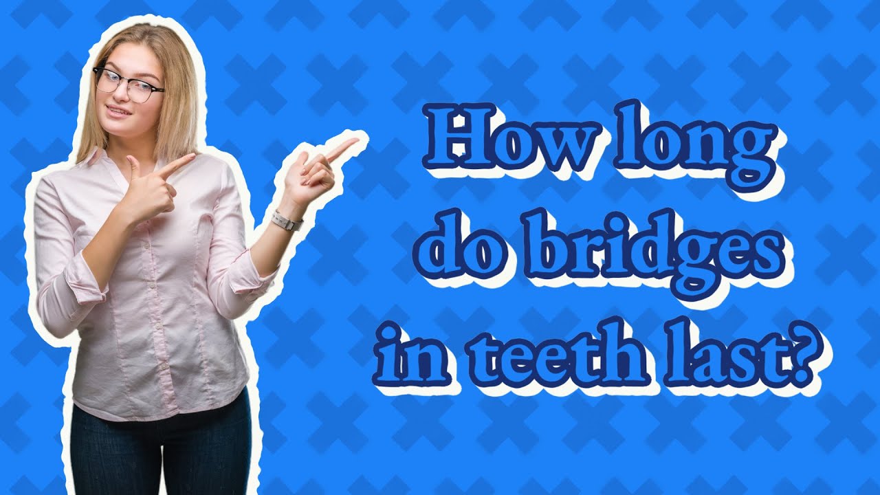 How long do bridges in teeth last? YouTube