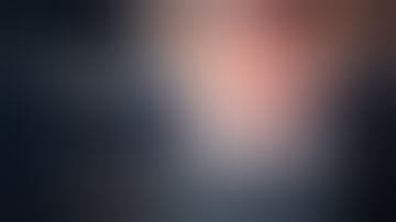 Laparoscopic Retrograde Appendicectomy | Dr. Imran Abdullah Khan