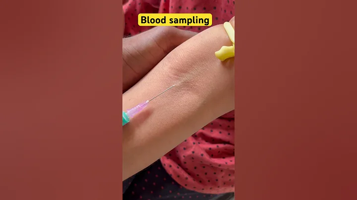 Blood collection techniques | blood collected procedure - DayDayNews