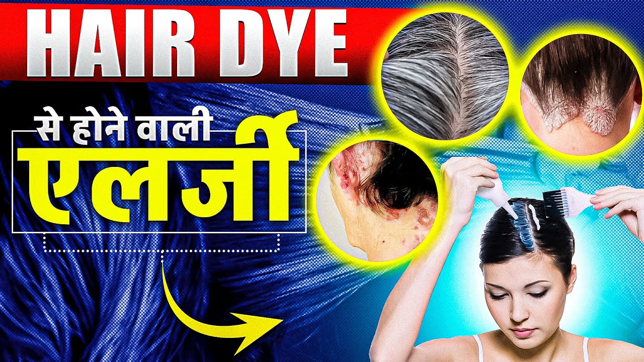 हेयर डाई से होने वाली एलर्जी Hair Dye Allergy Treatment and Symptoms Dr Geetika Srivastava