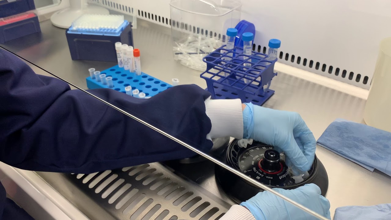 RNA Extraction for COVID 19 Diagnostics [CC]