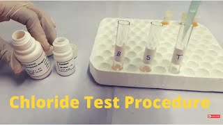 CHLORIDE Procedure | CHLORIDE Reagent Test-In English