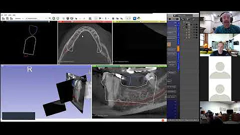 Zoom B4D Guide Module