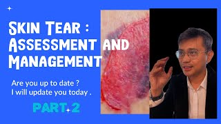 Skin Tear : Assessment and Management (International Skin Advisory Panel Standard )