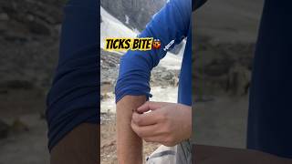 Tick bite while trekking😬 #trekking #hamptapass #mountains #travelvlog #adventure #trending