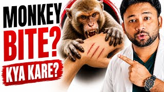 Monkey Bite Can Cause Rabies | Here's What To Do