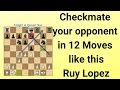 Checkmate Your Opponent in 12 Moves like this - Ruy Lopez | Johannes Zukertort vs Adolf Anderssen