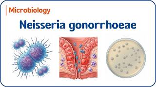 11. Neisseria gonorrhoeae 🦠Morphology, Pathogenesis & Diagnosis | USMLE & NEET-PG Microbiology 11. Neisseria gonorrhoeae 🦠Morphology, Pathogenesis & Diagnosis | USMLE & NEET-PG Microbiology