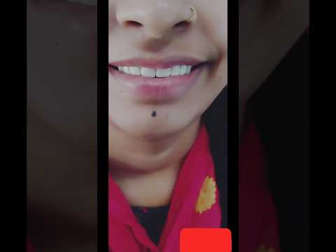 Before & After — Case 1