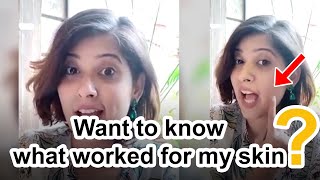 Skinkraft Review By Sheeki - A Customized Solution For All Skin Problems