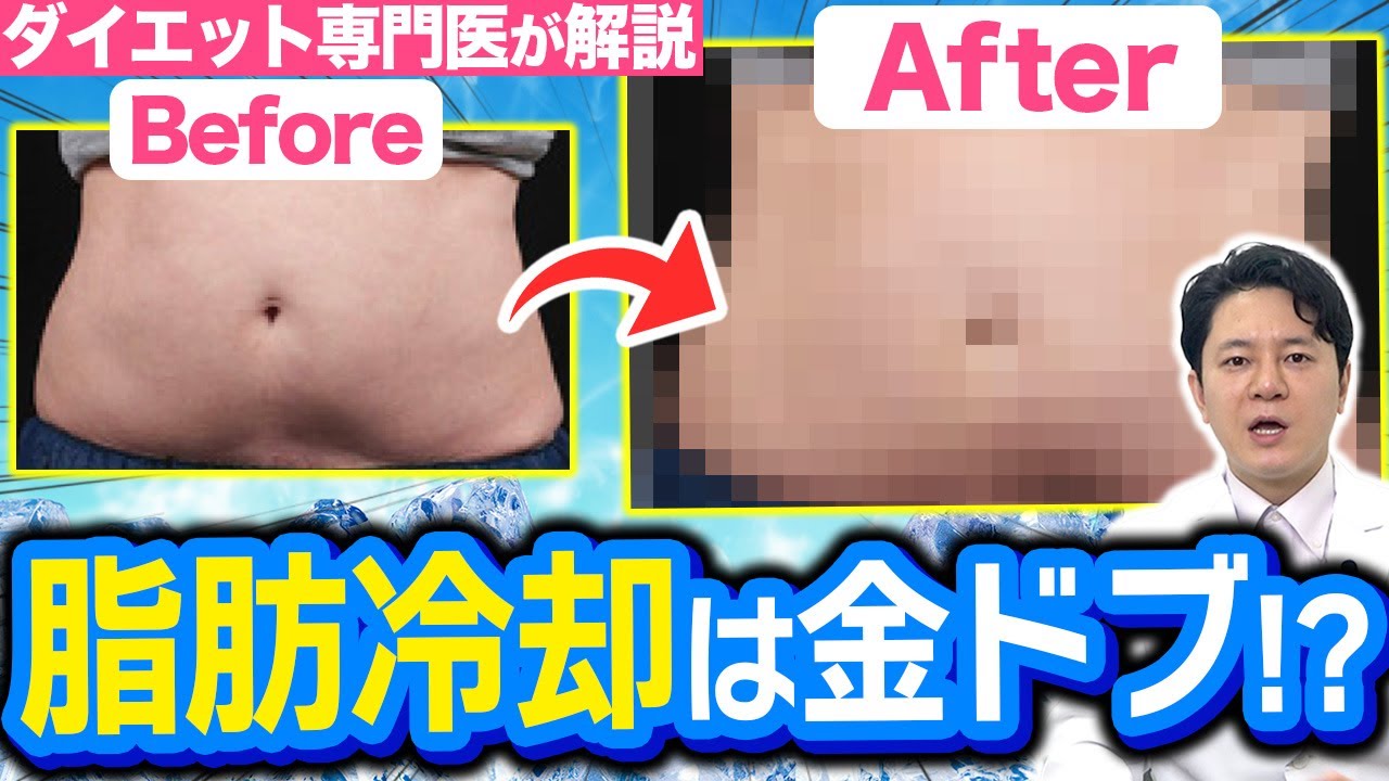 脂肪冷却は痩せない？驚きのメカニズムから効果を最大化する方法まで
