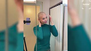 FROM 7FT LONG HAIR TO BALD - WOMAN'S ALOPECIA JOURNEY