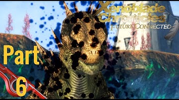 Full Assault | Xenoblade Chronicles: Future Connected | Part 6