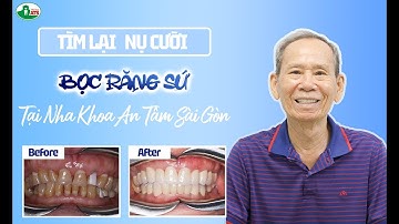 LỘT XÁC NỤ CƯỜI – HÀNH TRÌNH BỌC RĂNG SỨ CỦA BÁC VINH!