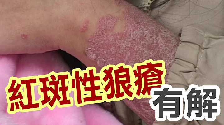 免疫功能失調 有救星了 - 天天要聞