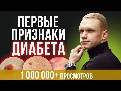 7 главных признаков диабета / Как понять что у вас преддиабет?