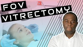 Floaters only vitrectomy (FOV) explained