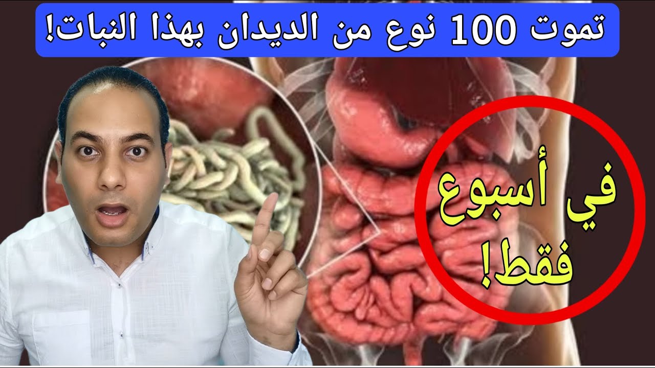 ملعقة كبيرة يوميا تقتل 100 نوع من الديدان/علاج الديدان الفوري!