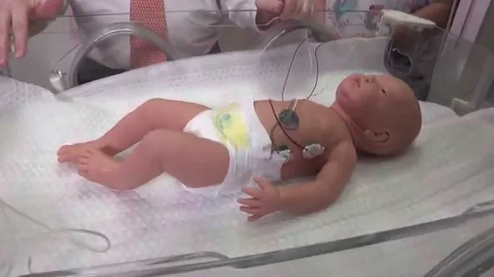 Dr. Jeffrey Kaiser explains whole body cooling at ...