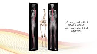 University Orthopedics Offers EOS Imaging