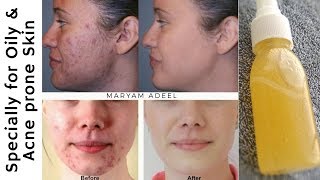 Diy toner for oily skin and combination acne prone skin, get rid large open pores urdu/Hindi |Maryam