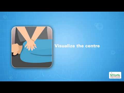 Cardio Pulmonary Resuscitation (CPR) Animation video, Cardiac Emergency, Fortis