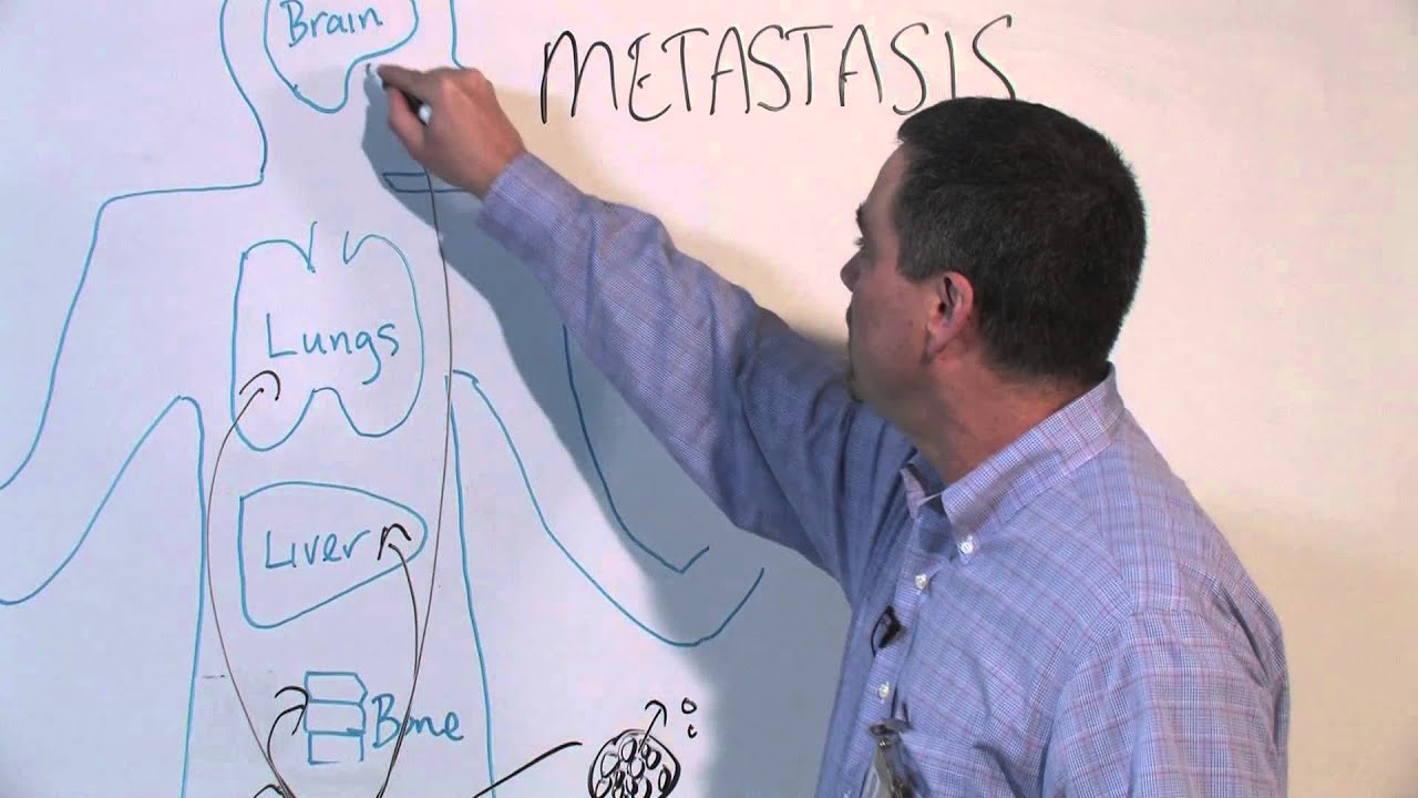 How Cancer Spreads (Metastasis) - Michael Henry, PhD
