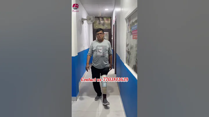 Above knee #prostheticlimb #ossur #nakli #walking #love #lifestyle #doctor #bornlife #prosthetics