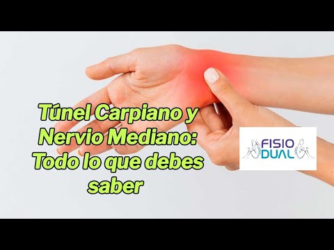 Túnel Carpiano y Nervio Mediano: Todo lo que debes saber
