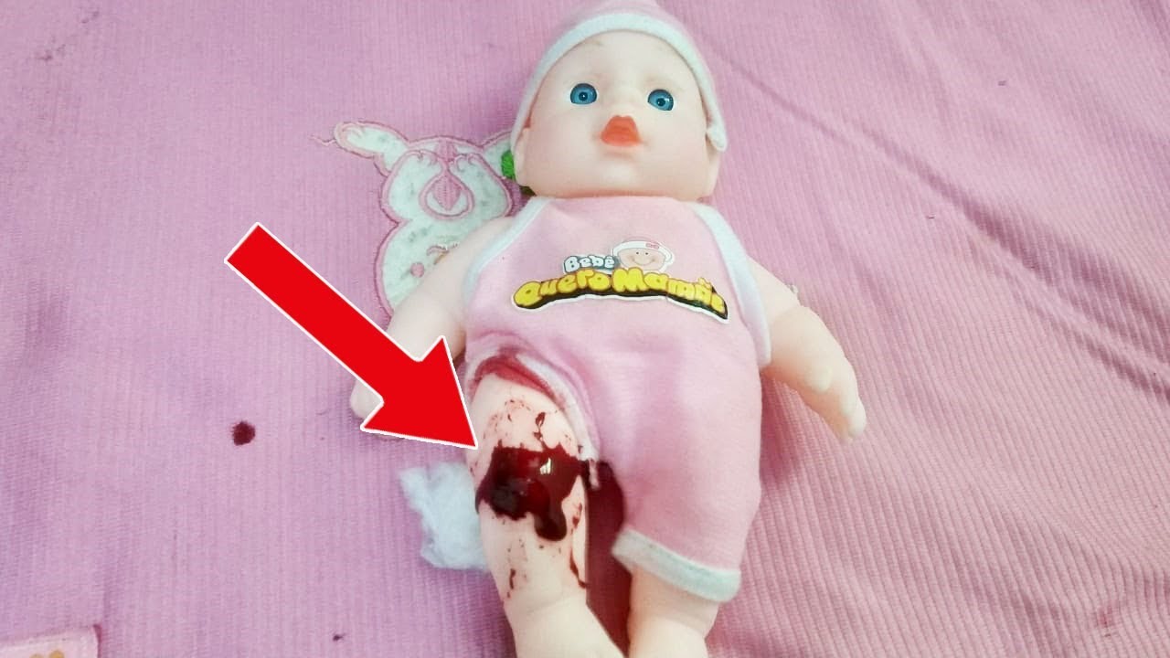 Menolong Boneka  Bayi  Terluka Karena Jatuh Saat Jalan Jalan 