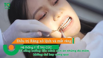 🔺 Niềng răng mắc cài - Giải pháp hiệu quả điều trị răng xô lệch và mất răng