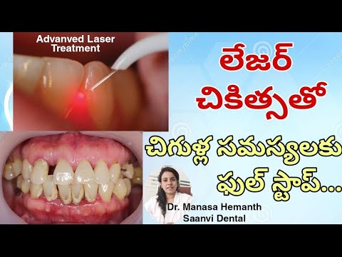 Gum Problems || Laser Treatment || Flap Surgery || Saanvi Dental