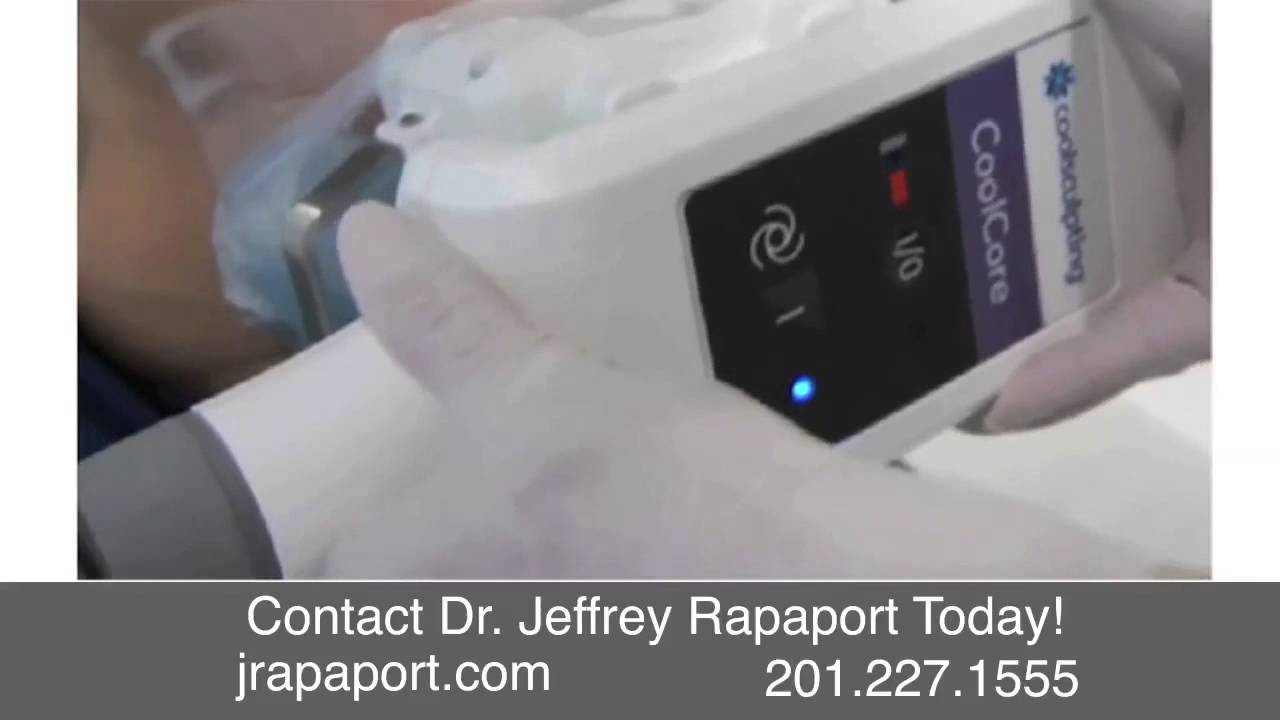 New Jersey Coolsculpting, Dr. Jeffrey Rapaport YouTube