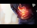 حرقة المعدة حموضة المعدة الارتجاع المعدي المريئي الاسباب و الأعراض والعلاج الطبيعي الفعال والسريع 