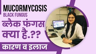Black Fungus (mucormycosis) Symptoms, Effects and Prevention Dr Neha Chahar
