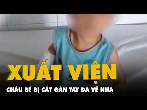 Video Cháu bé 3 tuổi bị cắt đứt gân tay, đứt mạch máu đã... - youtube