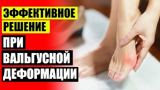 🤥 ПЛОСКО ВАЛЬГУСНАЯ ДЕФОРМАЦИЯ СТОП УПРАЖНЕНИЯ
