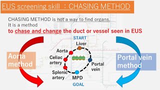 【CHASING METHOD】Linear EUS screening in the stomach