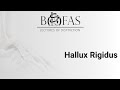 Hallux rigidus  bofas lectures of distinction