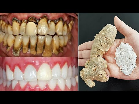 A natural recipe for whitening teeth, removing yellowing and dissolving ...