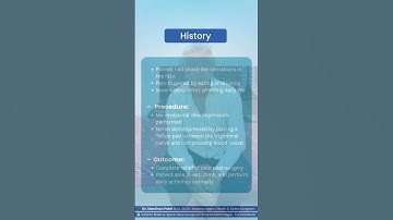 Trigeminal Neuralgia Treated with Microvascular Decompression