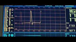 Skyfall - Men, Women, And Children Trailer Mashup