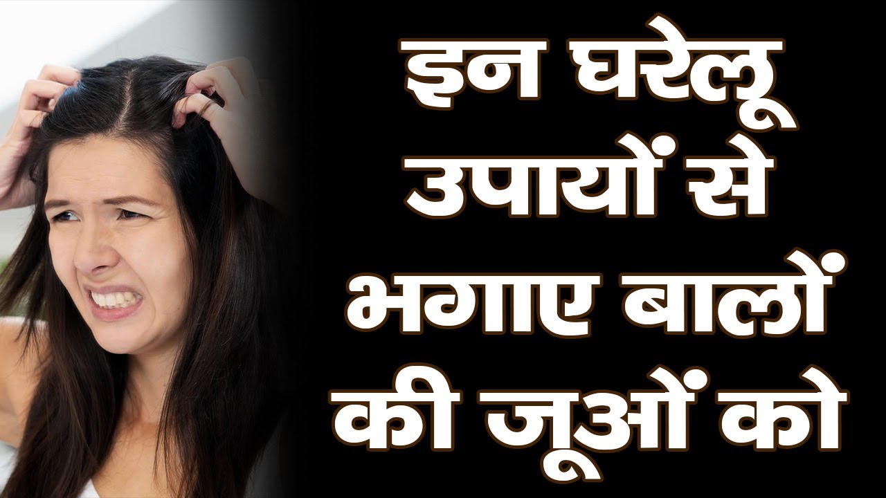 इन घरेलू उपायों से भगाएं बालों की जुओं को || Get Rid Of Lice || Health Tips In Hindi