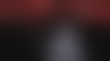 Robotic Retroperitoneal Left Partial Nephrectomy with Ultrasound scouting