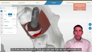 Tip Of The Day Contouring The Tissue